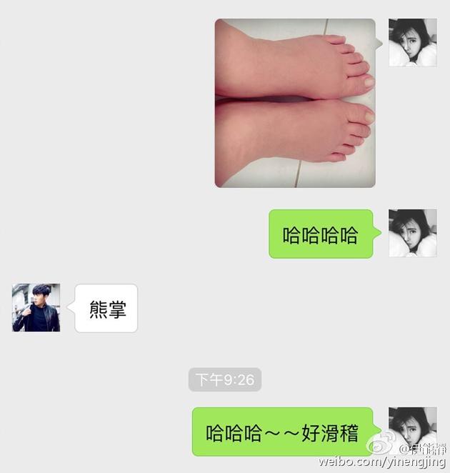伊能靜臨產(chǎn)腳腫肚子過(guò)敏
