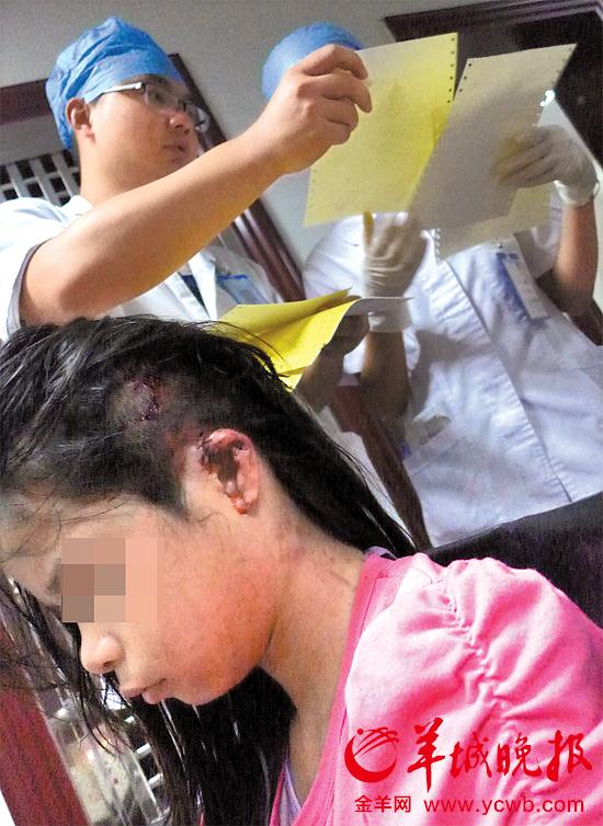 受傷的11歲女孩頭發(fā)被卷入扶梯，耳朵被嚴(yán)重拉傷，需手術(shù)。