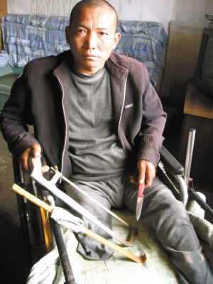 鄭艷良就是用這幾樣簡陋工具，給自己做了右腿截肢手術。