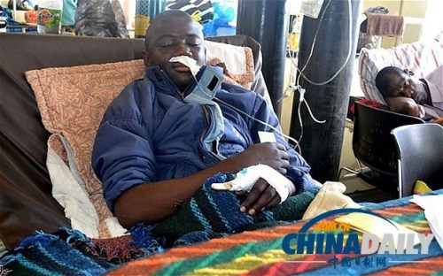 雖然已經(jīng)在醫(yī)院接受了近一個月的恢復治療，卡托卡的身體仍然非常虛弱。