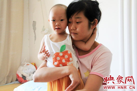 孩子和媽媽在一起，她的右眼已經(jīng)失明。