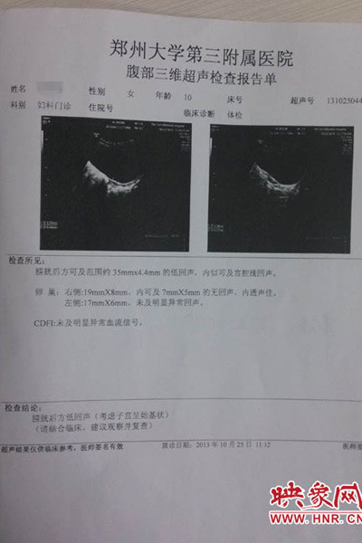 鄭州大學第三附屬醫(yī)院鑒定結(jié)果