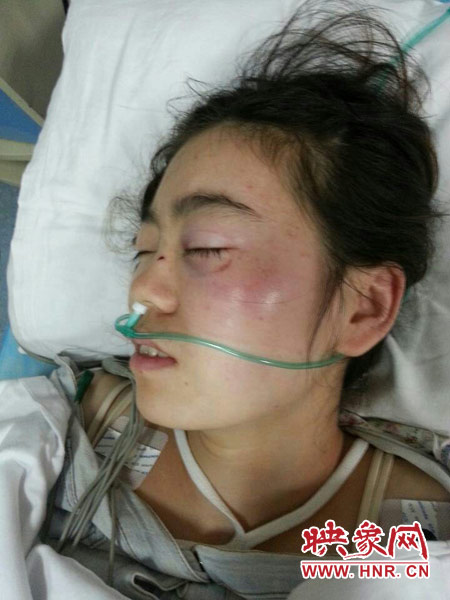 9月10日晚,被暴打的小陳出現(xiàn)了間歇性昏迷,被送進(jìn)了省人民醫(yī)院。