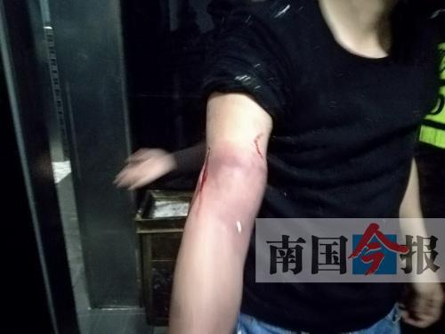 覃先生手臂被卡的部位受傷流血，所幸傷勢無大礙。 通訊員 王建民 攝