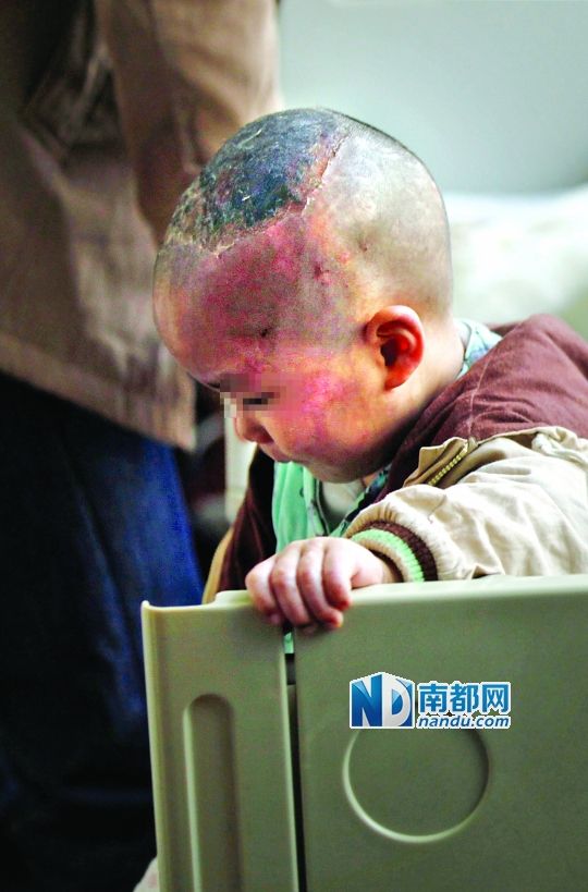 1月8日下午，小寶頭上和臉上都是傷痕。
