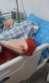 砸窗當(dāng)事人胡女士在醫(yī)院接受治療。