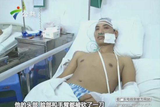 另一名傷者頭部、臉部和手臂都被砍了一刀。(視頻截圖)