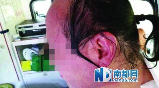 涉事教師遭熱水潑臉后的照片。