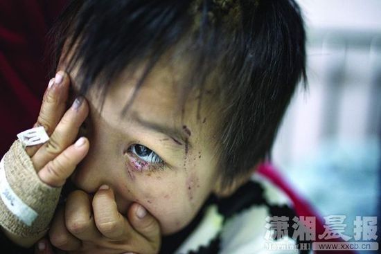 1月13日，湖南省兒童醫(yī)院，4歲的源源用手蒙住了眼睛。