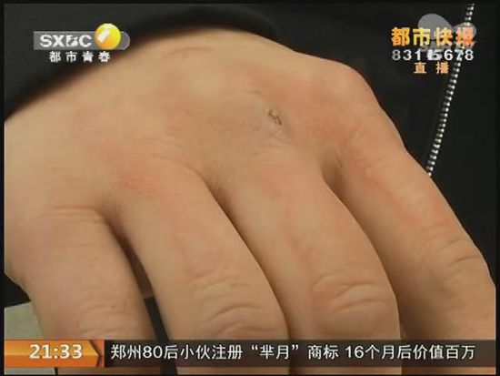 說(shuō)到這足療拔罐，估計(jì)大伙都不陌生，但是想起4號(hào)晚上的拔罐的經(jīng)歷，呂先生現(xiàn)在想起來(lái)，還心有余悸。