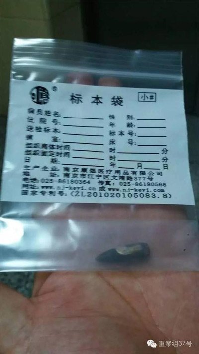 經警方鑒定，秦女士體內取出的子彈系56式步槍射出 。 受訪者供圖