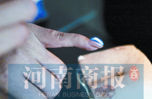 將指甲油涂在指甲上，靠近火焰時(shí)被引燃了