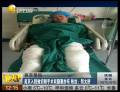 吳京入院做切割手術雙腿裹紗布