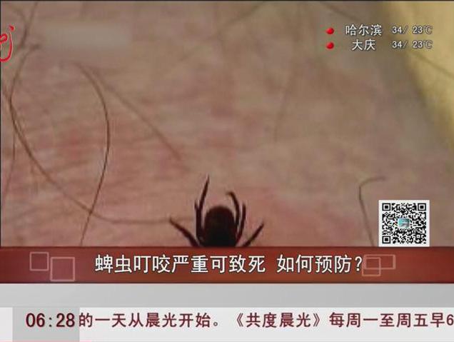 蜱蟲叮咬嚴(yán)重可致死如何預(yù)防？